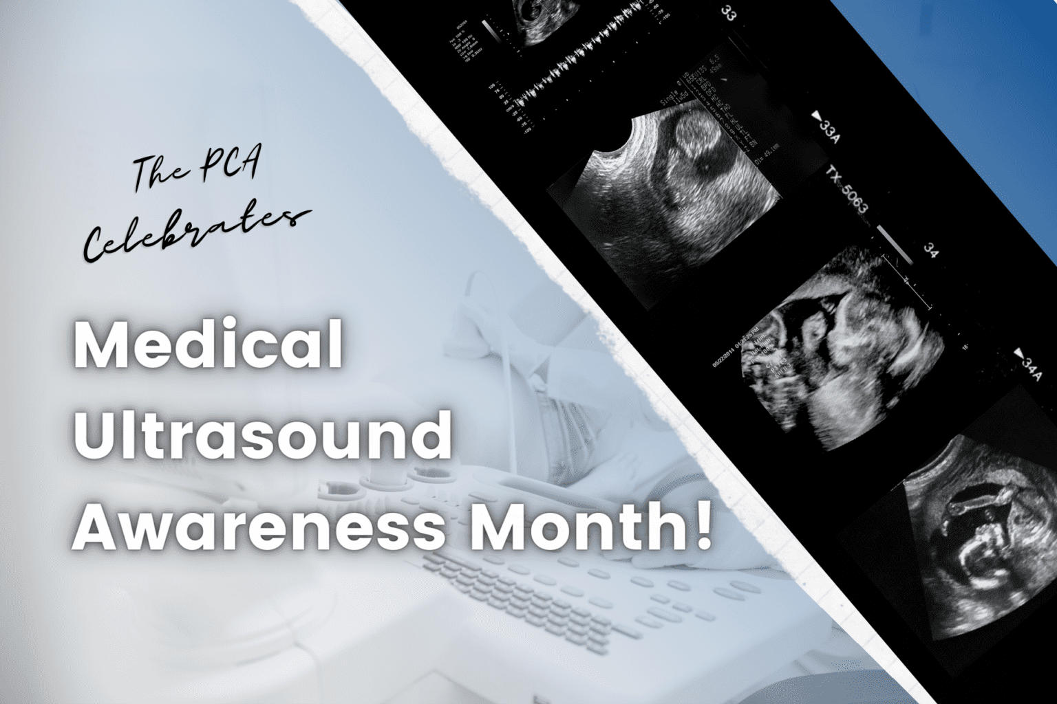 The PCA Celebrates Medical Ultrasound Awareness Month!