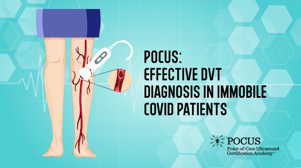 POCUS: Effective DVT Diagnosis in Immobile COVID Patients