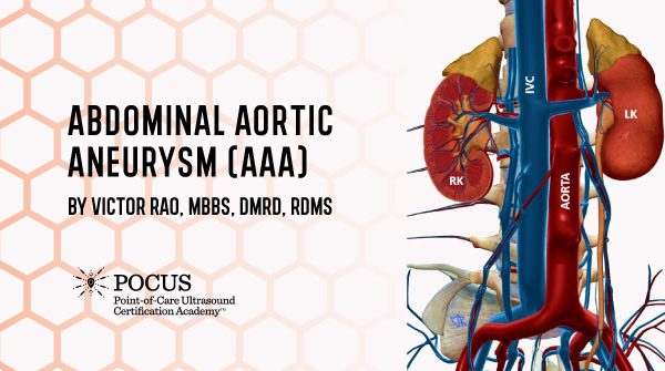 Abdominal Aortic Aneurysm (AAA)