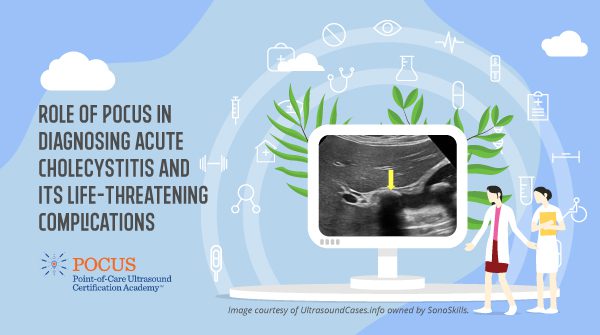 Role of POCUS in Diagnosing Acute Cholecystitis and its Life-Threatening Complications