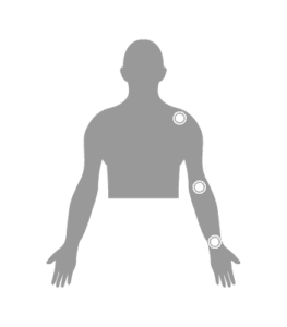 Musculoskeletal Upper Extremity