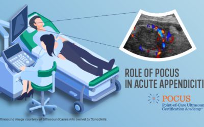 Role of POCUS in Acute Appendicitis
