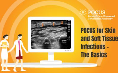 POCUS for Skin and Soft Tissue Infections (Is it Cellulitis or an Abscess?) – The Basics