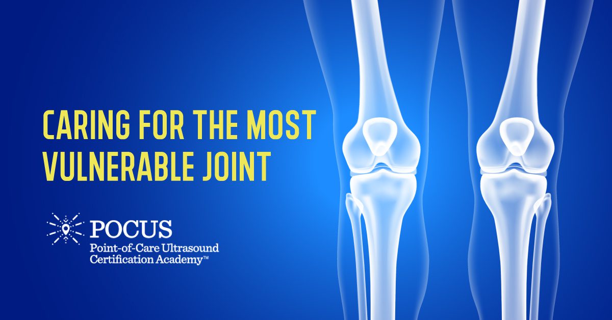 Caring For the Most Vulnerable Joint PointofCare Ultrasound