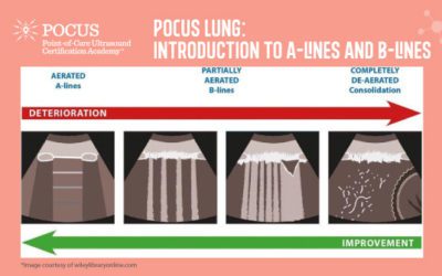POCUS Lung – Introduction to A-lines and B-lines