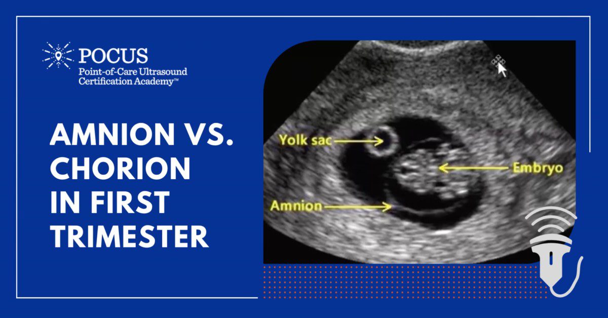 Amnion vs Chorion in the 1st Trimester POCUS Resources & Case Studies