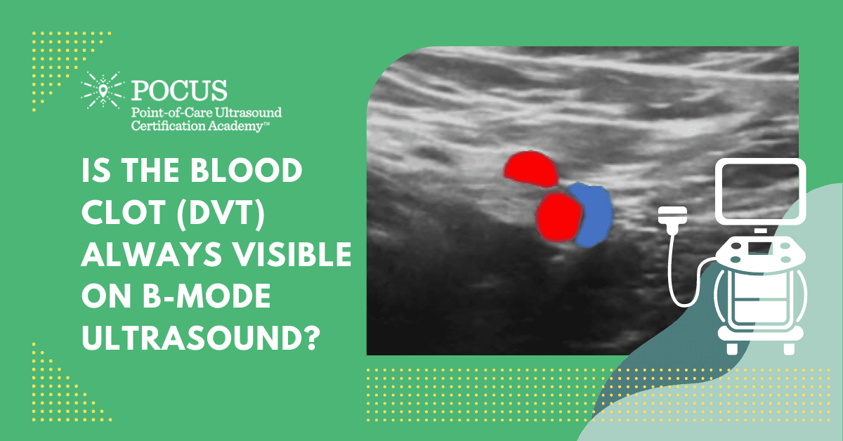 Deep Vein Thrombosis (DVT) Is the Blood Clot (DVT) Always Visible on