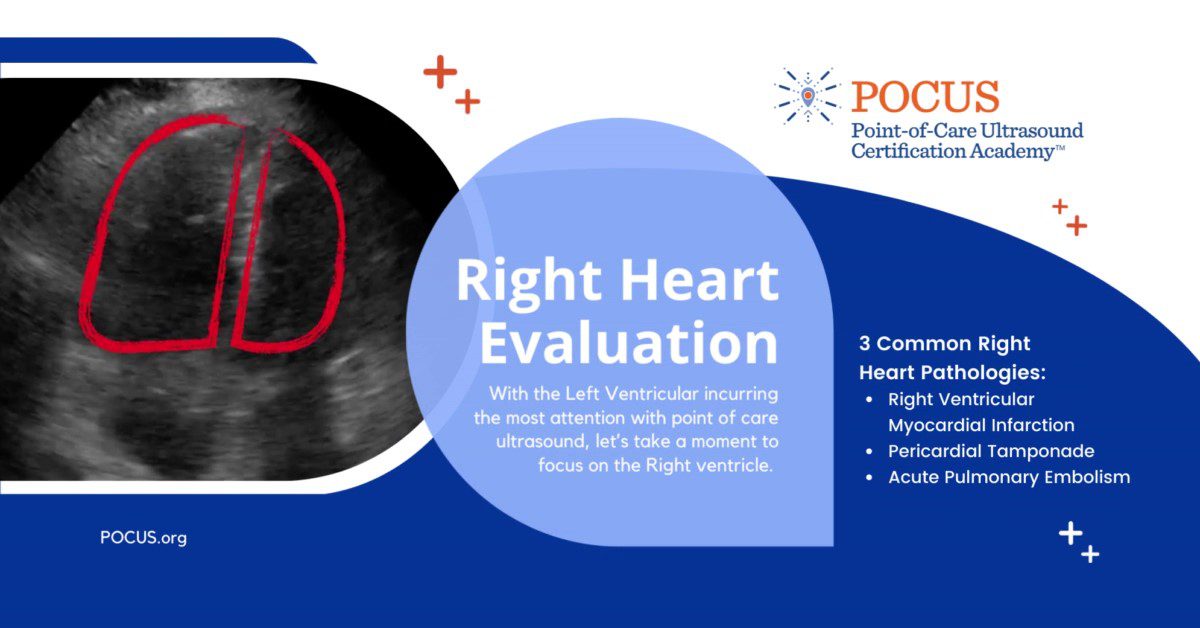 right-heart-evaluation-point-of-care-ultrasound-certification-academy