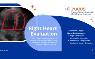 Right Heart Evaluation