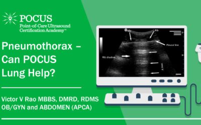 Pneumothorax – Can POCUS Lung Help?