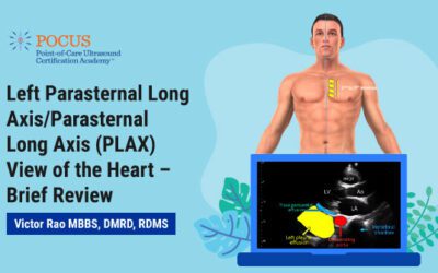 Left Parasternal Long Axis/Parasternal Long Axis (PLAX) View of the Heart – Brief Review