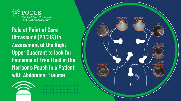 Role of POCUS in Assessment of the Right Upper Quadrant to look for Evidence of Free Fluid in the Morison’s Pouch in a Patient with Abdominal Trauma