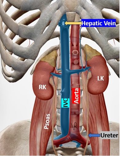IVC anatomy