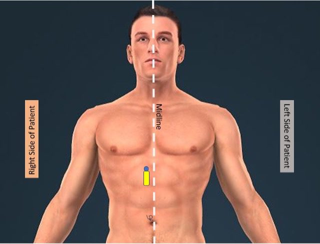 IVC transducer location
