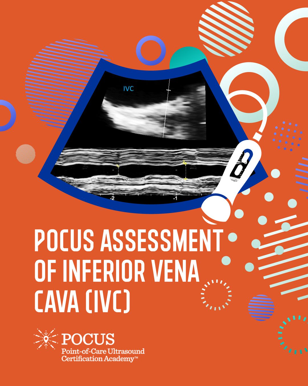 IVC blog graphic