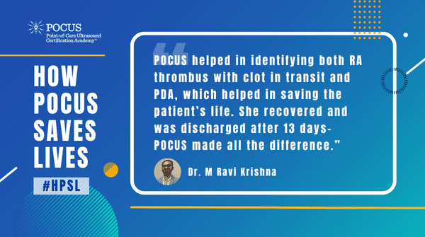 How POCUS saves lives Krishna testimonial