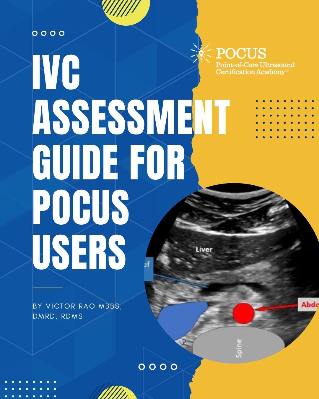 IVC assessment blog