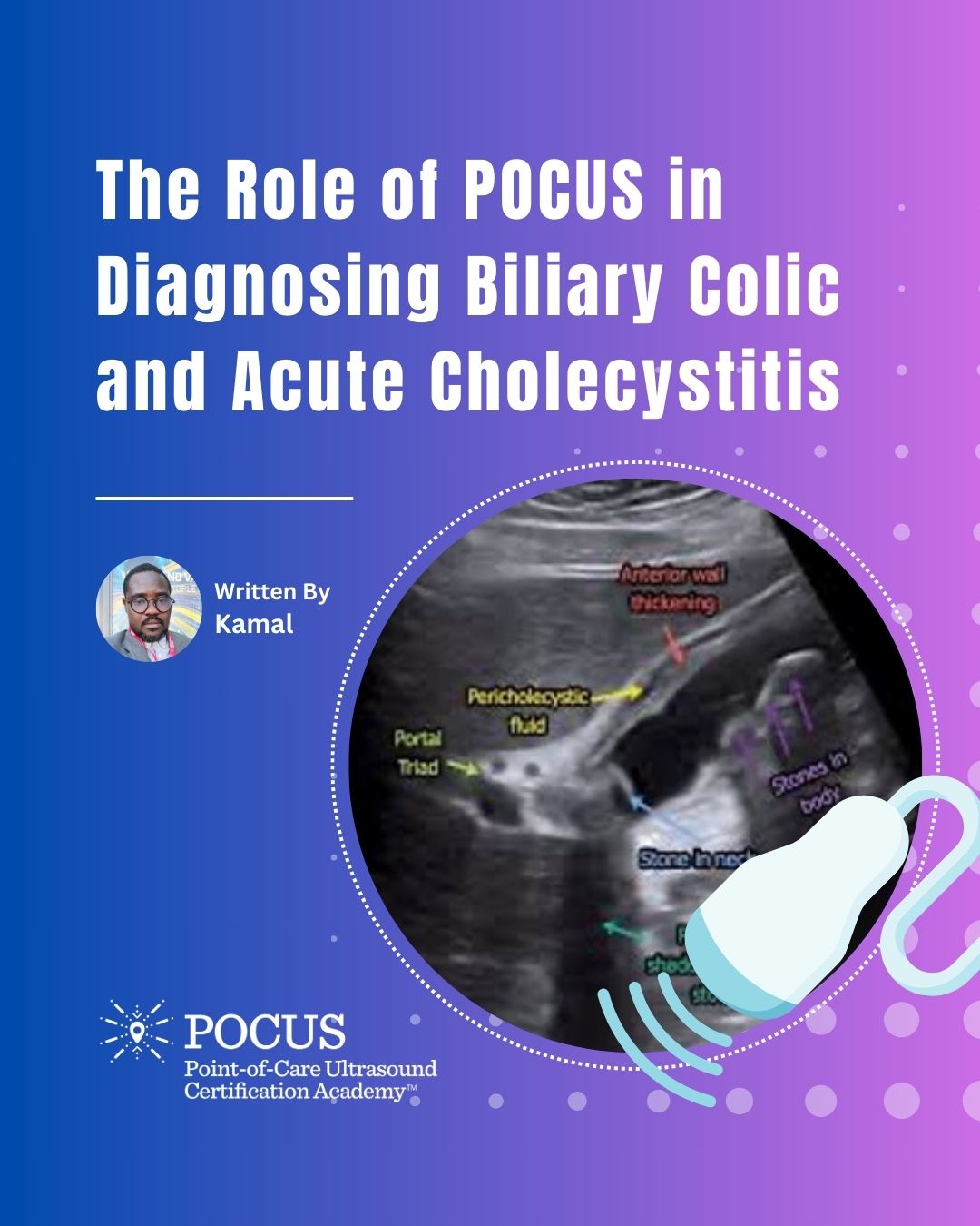 Biliary colic blog