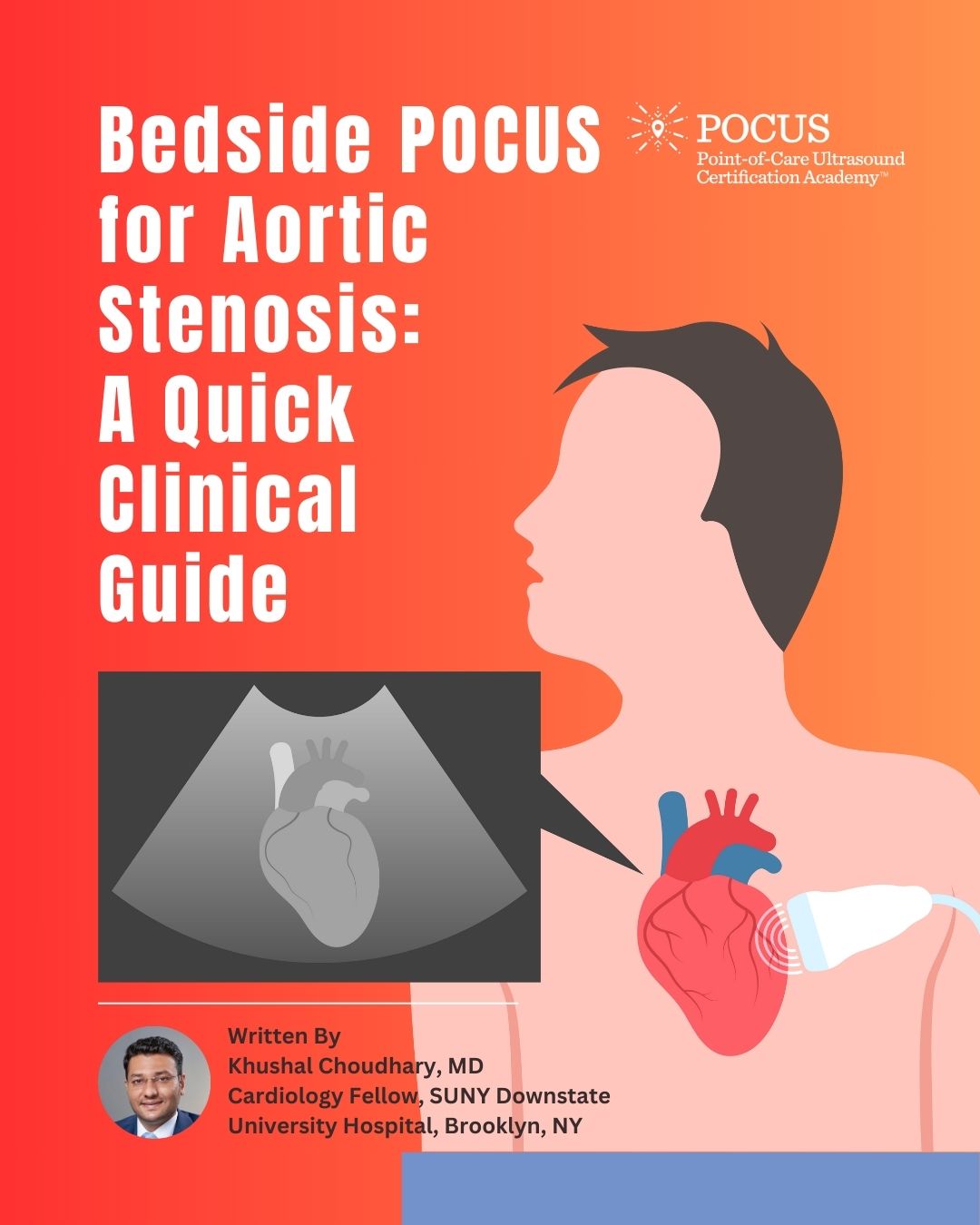 Aortic stenosis blog graphic