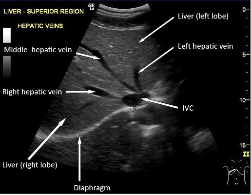 View of normal liver parenchyma