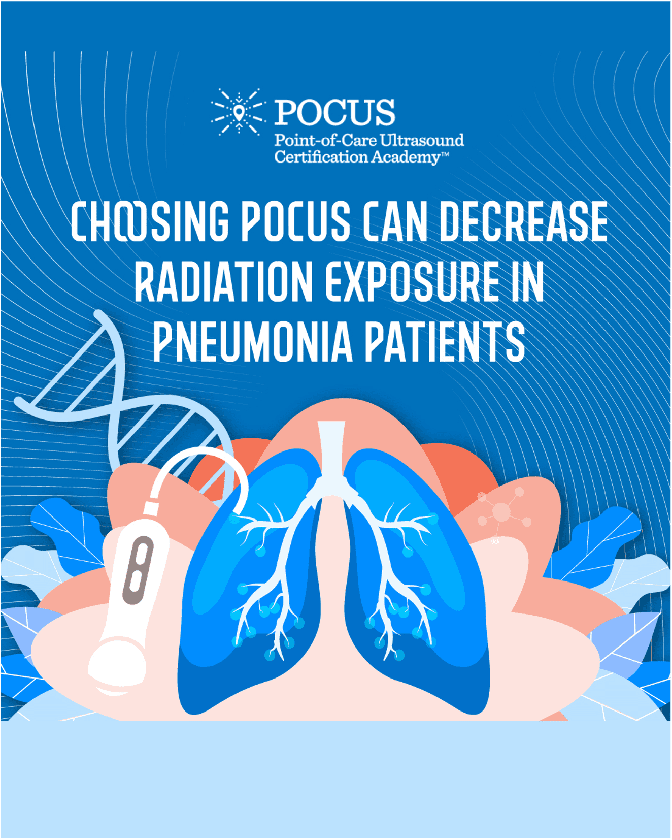 Pneumonia blog graphic
