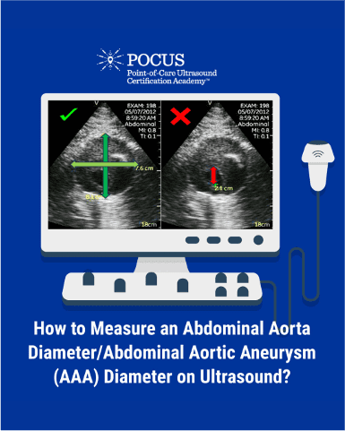AAA measurement blog graphic