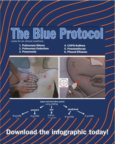 Blue protocol infographic image