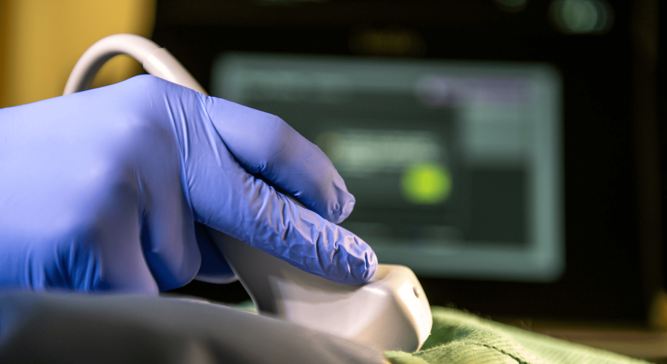 Gloved Hand Performing Ultrasound Gloved hand performing ultrasound