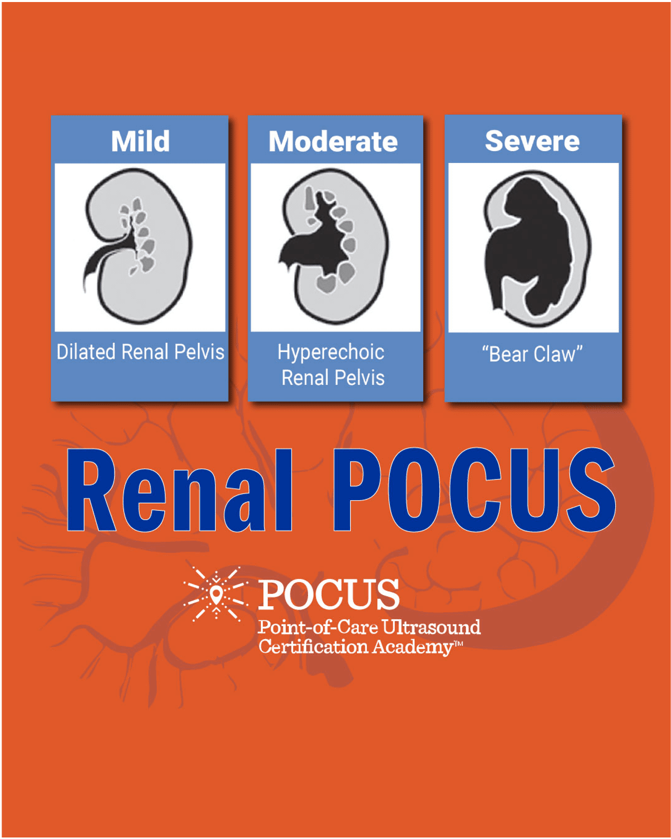 Renal POCUS infographic
