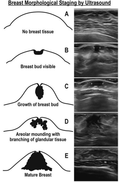 Illustrated depiction of breast development