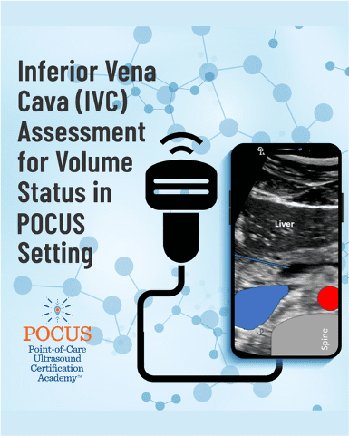 IVC blog graphic