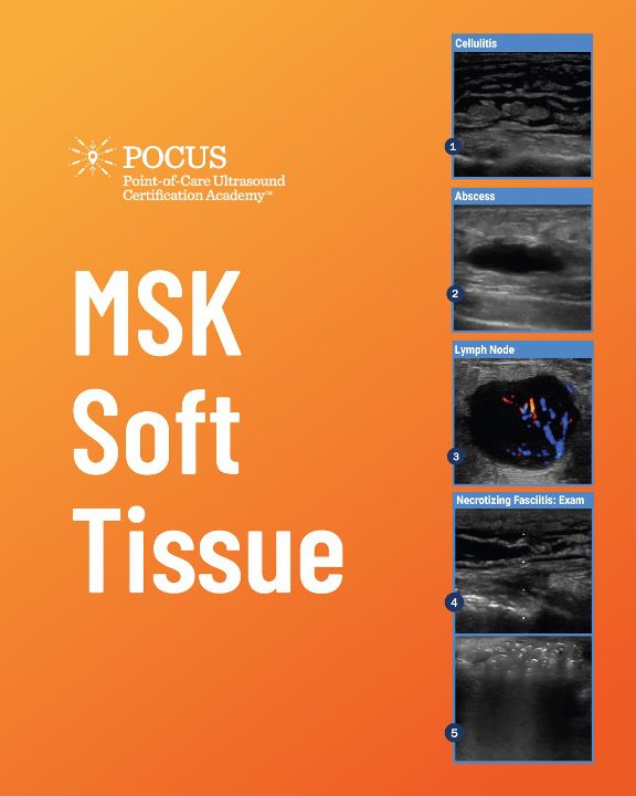 Graphic view of MSK soft tissue infographic