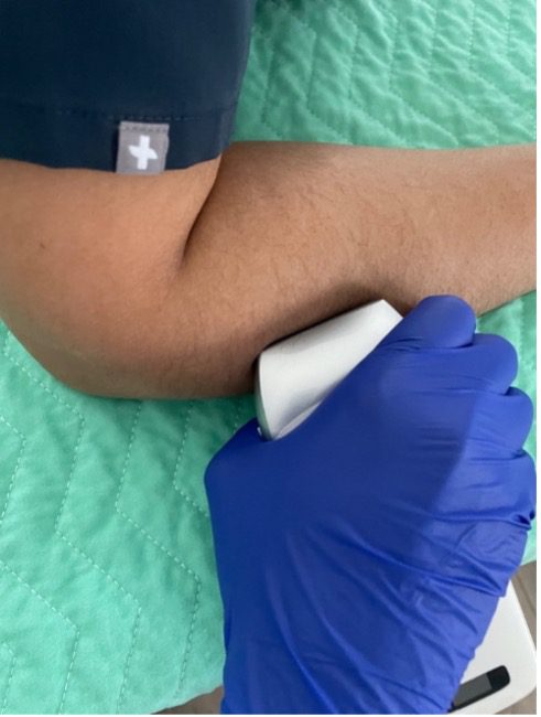 Image of patient arm and ultrasound probe with improper positioning