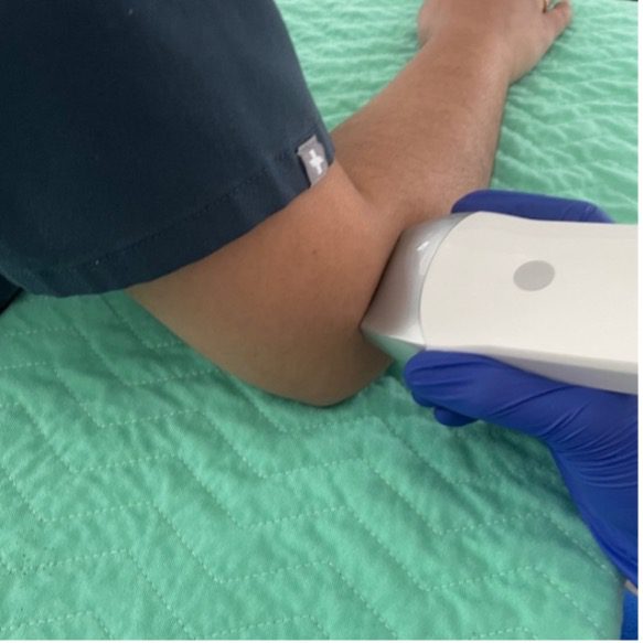 Image of patient arm and ultrasound probe position in longitudinal view