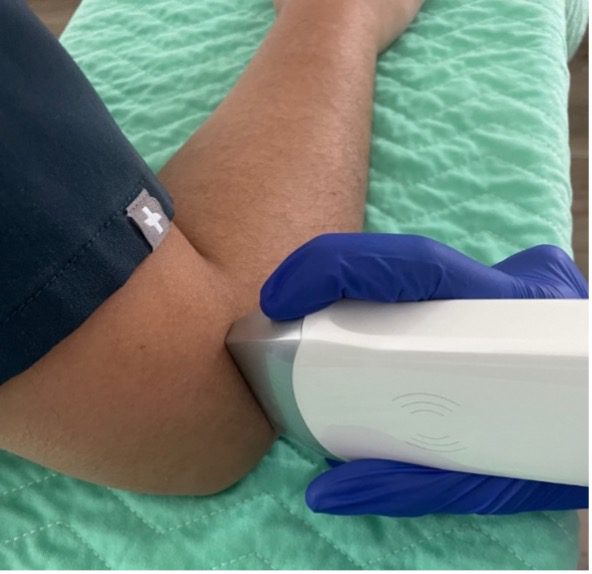 Image of patient arm and ultrasound probe position for transverse view