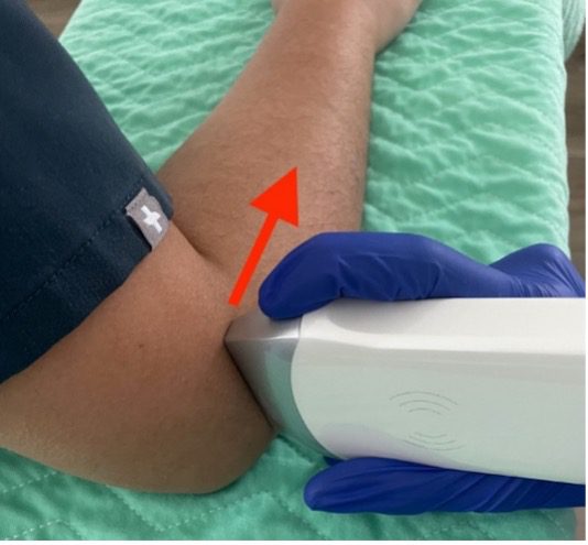 Image of patient arm and ultrasound probe position for transverse view