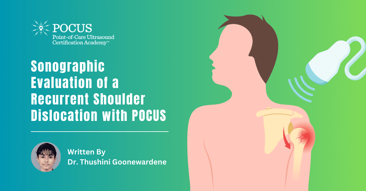 Graphic title for shoulder dislocation article