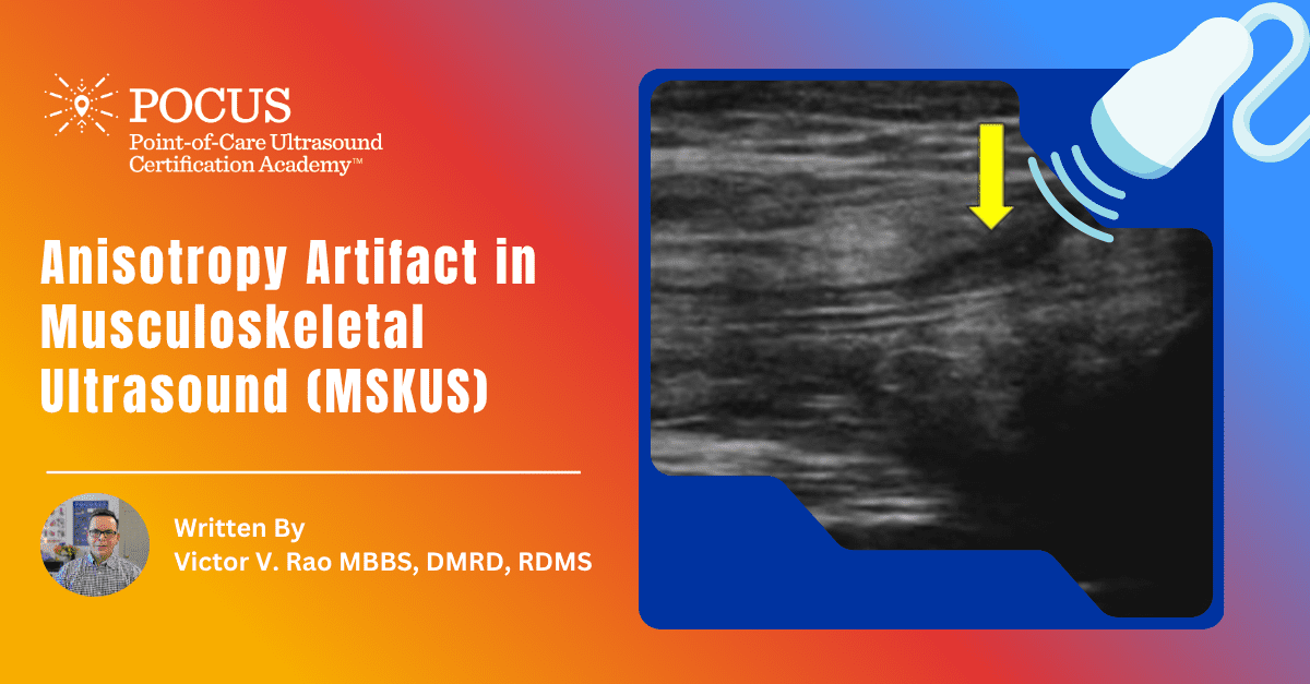 Graphic title for anisotropy artifact in MSK ultrasound blog