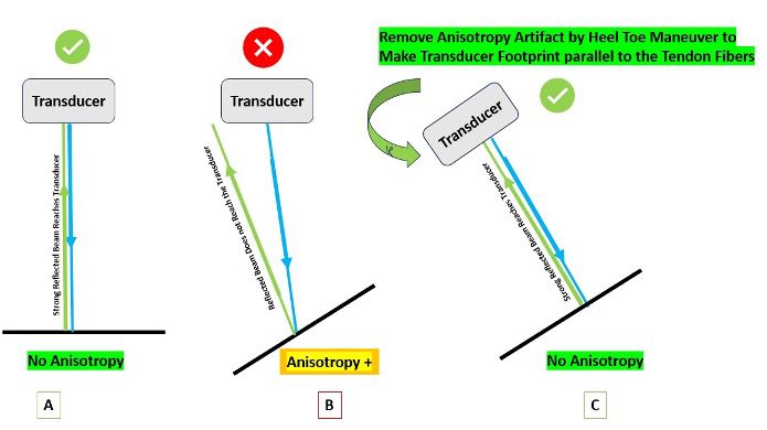 Diagrammatic view of anisotropy