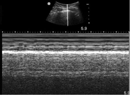 Ultrasound image of seashore sign