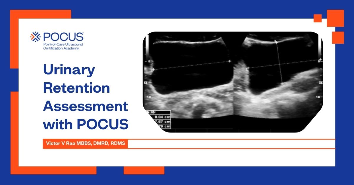 Graphic title of urinary retention blog