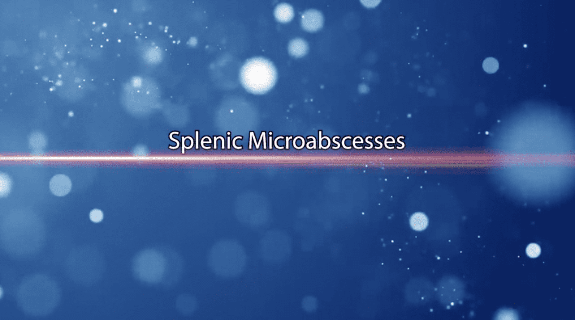 Splenic Microabscesses | POCUS Resources & Case Studies | POCUS.org