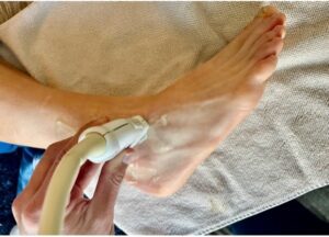 View of probe placement on ankle