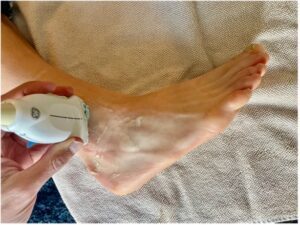 View of probe placement on ankle